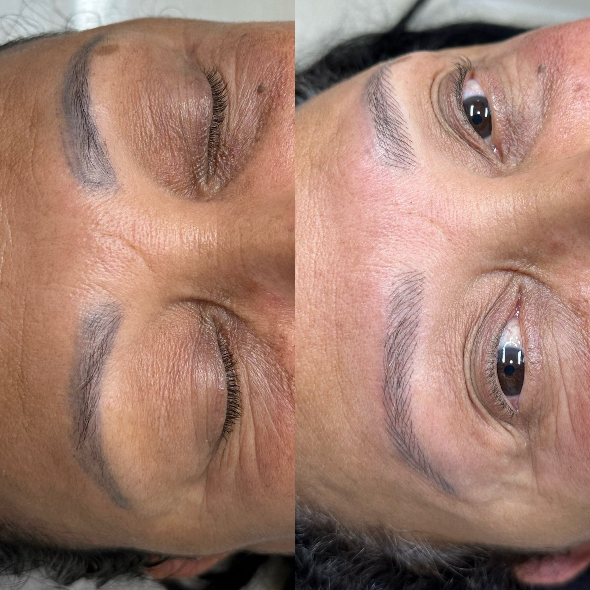 Resultado real do Protocolo Renova Skin: antes e depois