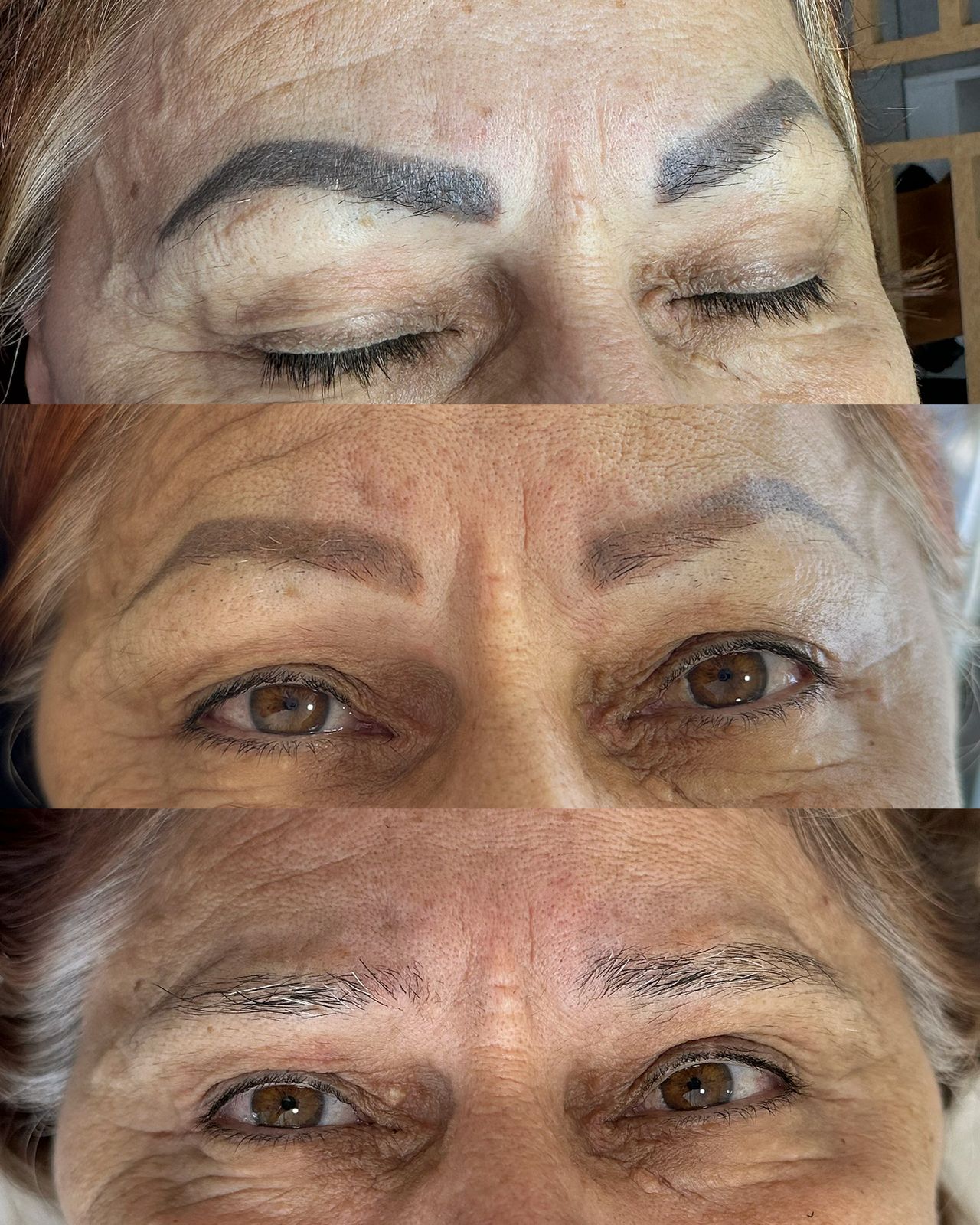 Antes e depois , Remoção e reconstrução natural