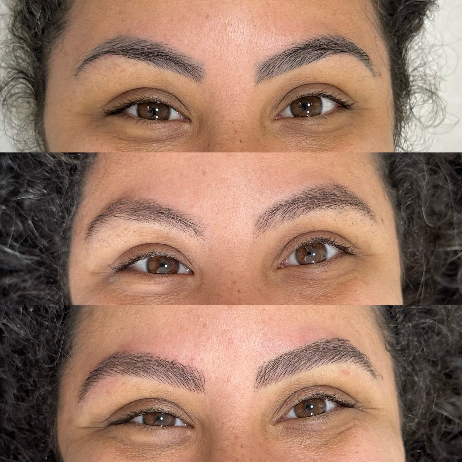 Antes e depois , Método Renova Skin 